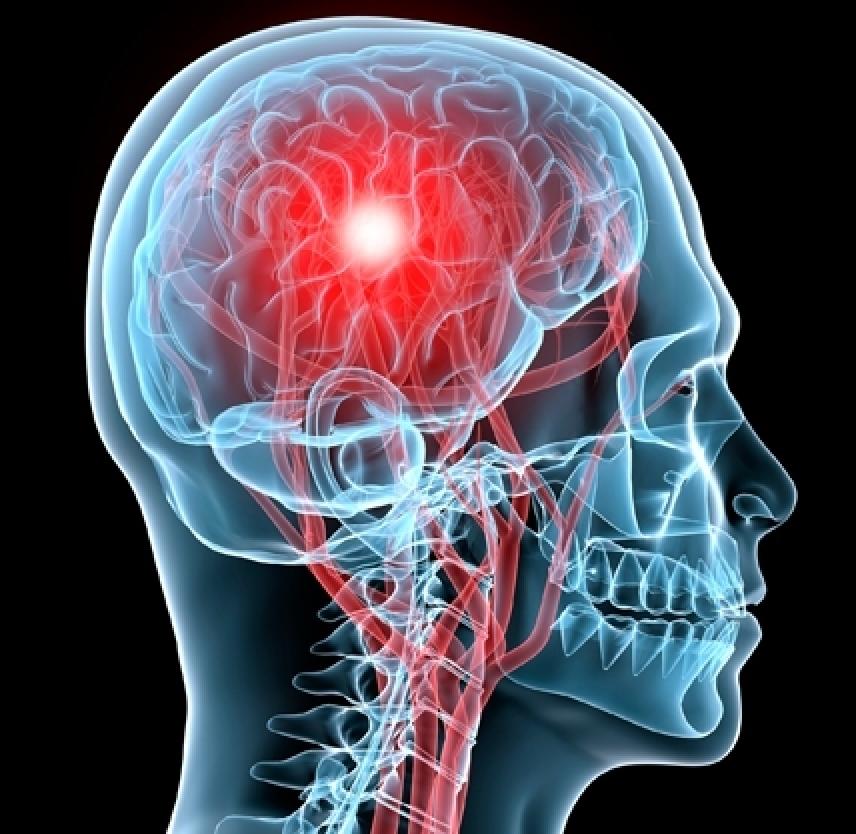 head